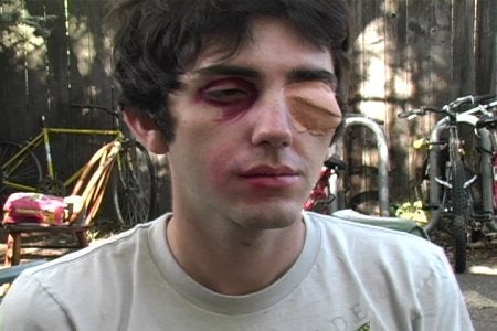 How To Make Someone Look Beat Up 4 Steps With Pictures Instructables How To Make Someone Look Beat Up 4 Steps With Pictures Instructables