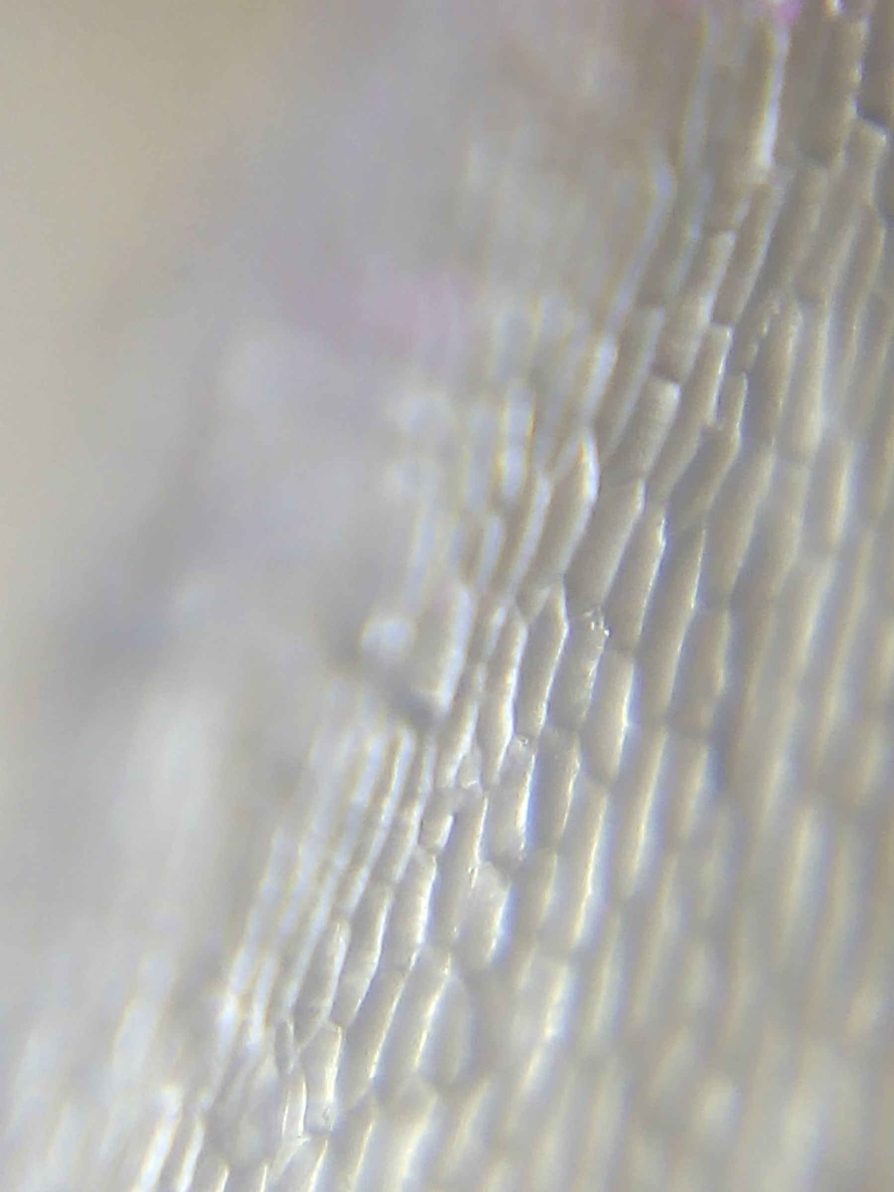 $10 Smartphone to Digital Microscope Conversion!