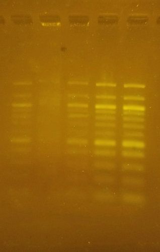 dna gel electrophoresis