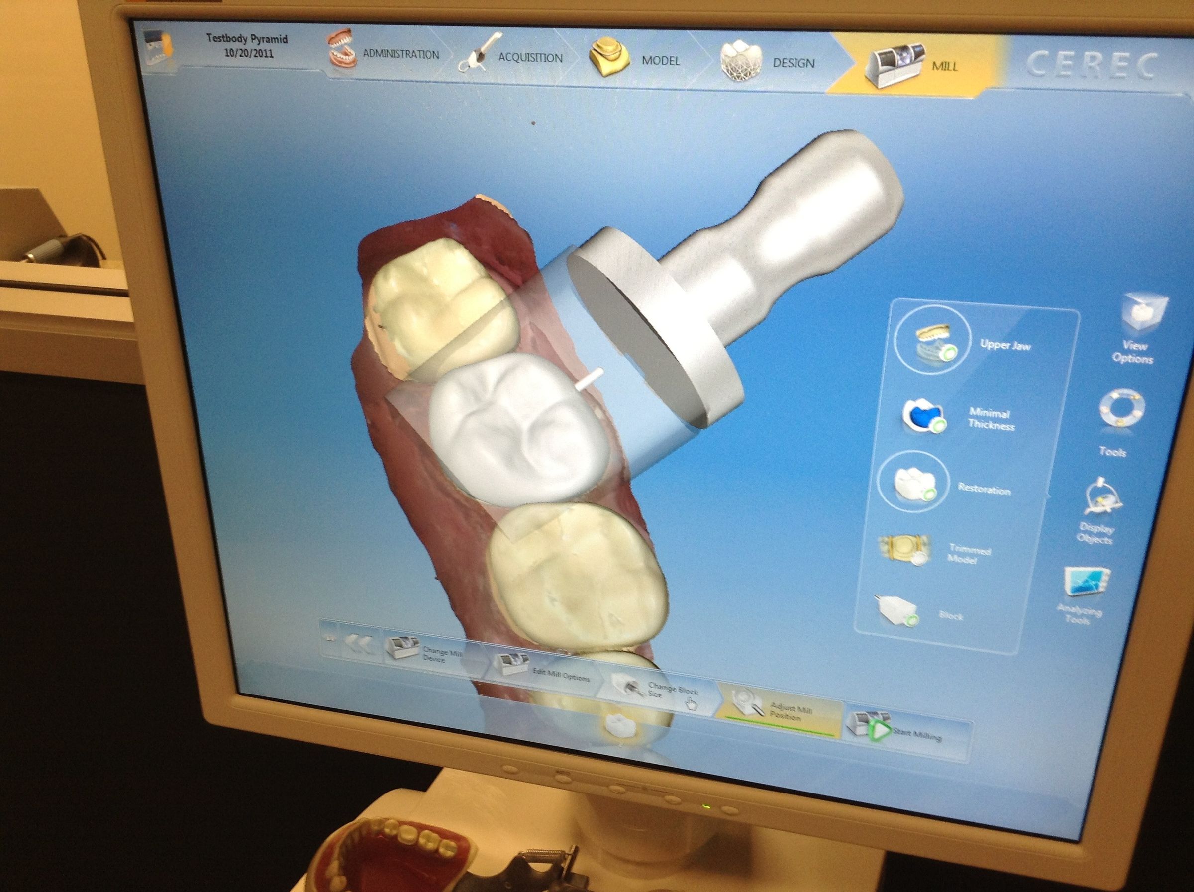 How to Fix a Tooth With CAD/CAM (CEREC) : 9 Steps (with Pictures ...