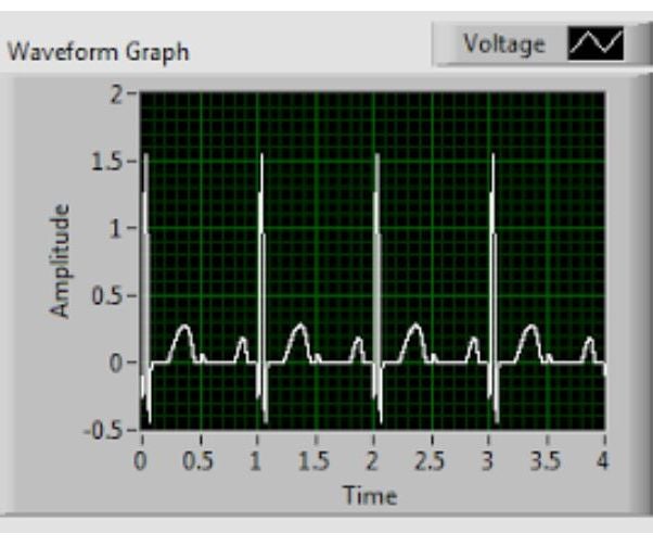 Simple ECG Circuit and LabVIEW Heart Rate Program 6 Steps Instructables