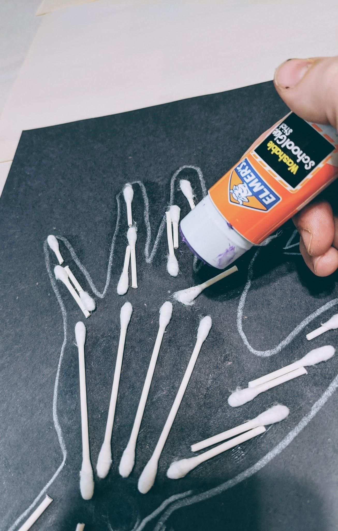 Xray Bones of the Hand 5 Steps Instructables