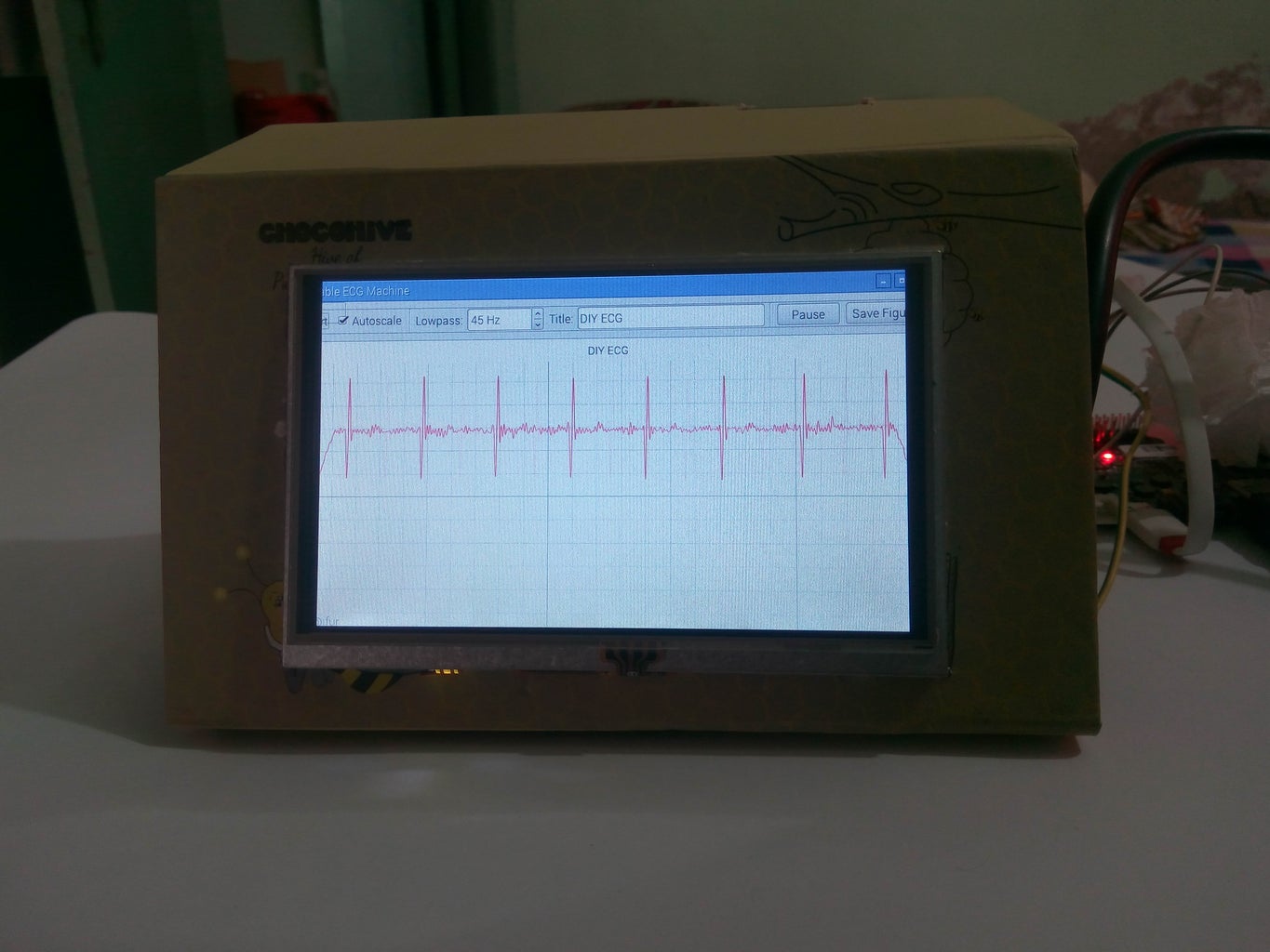 Portable ECG Machine 9 Steps with Pictures Circuit Diagram