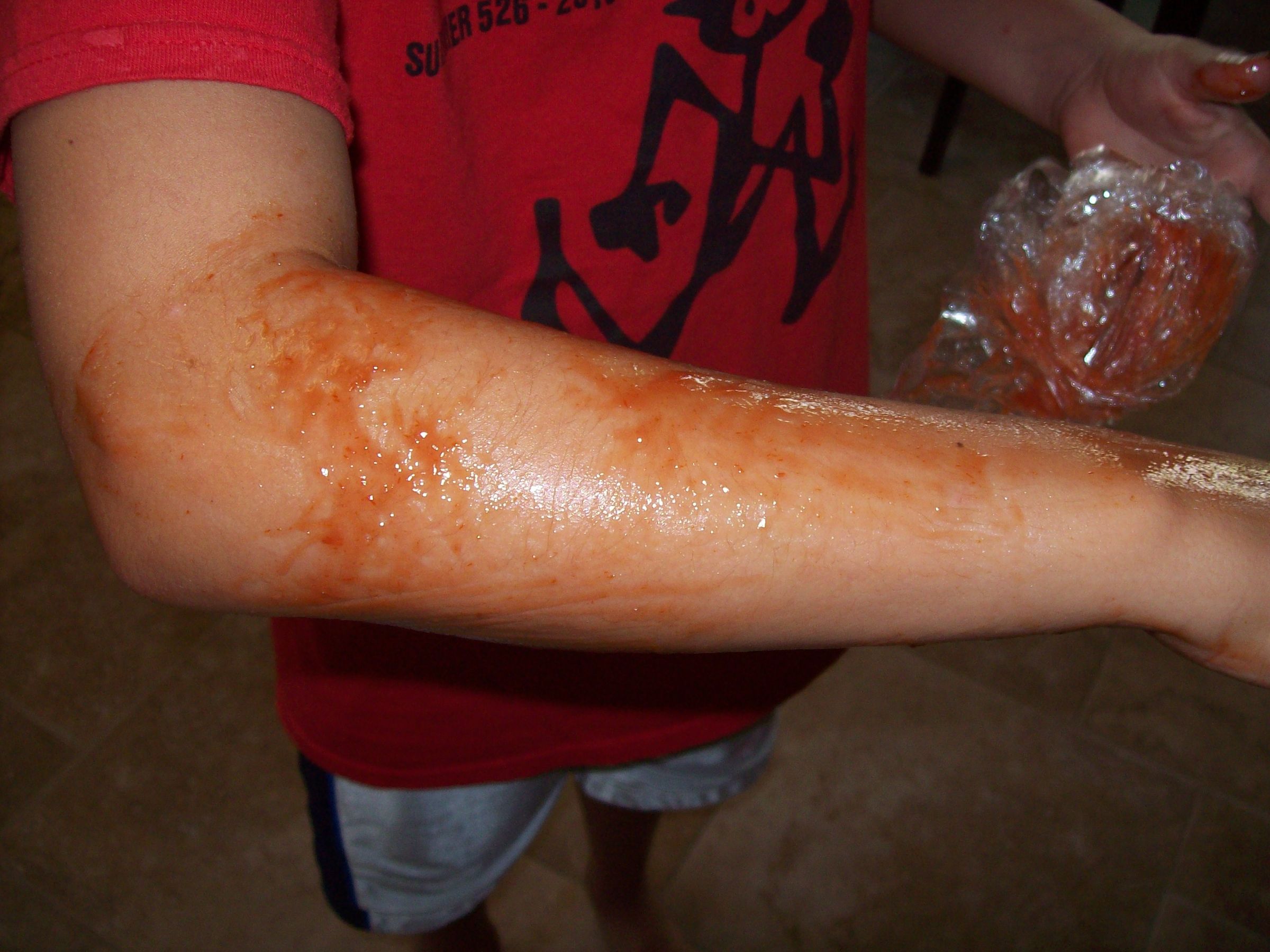 zombie arm DIY Project DIY Project Image