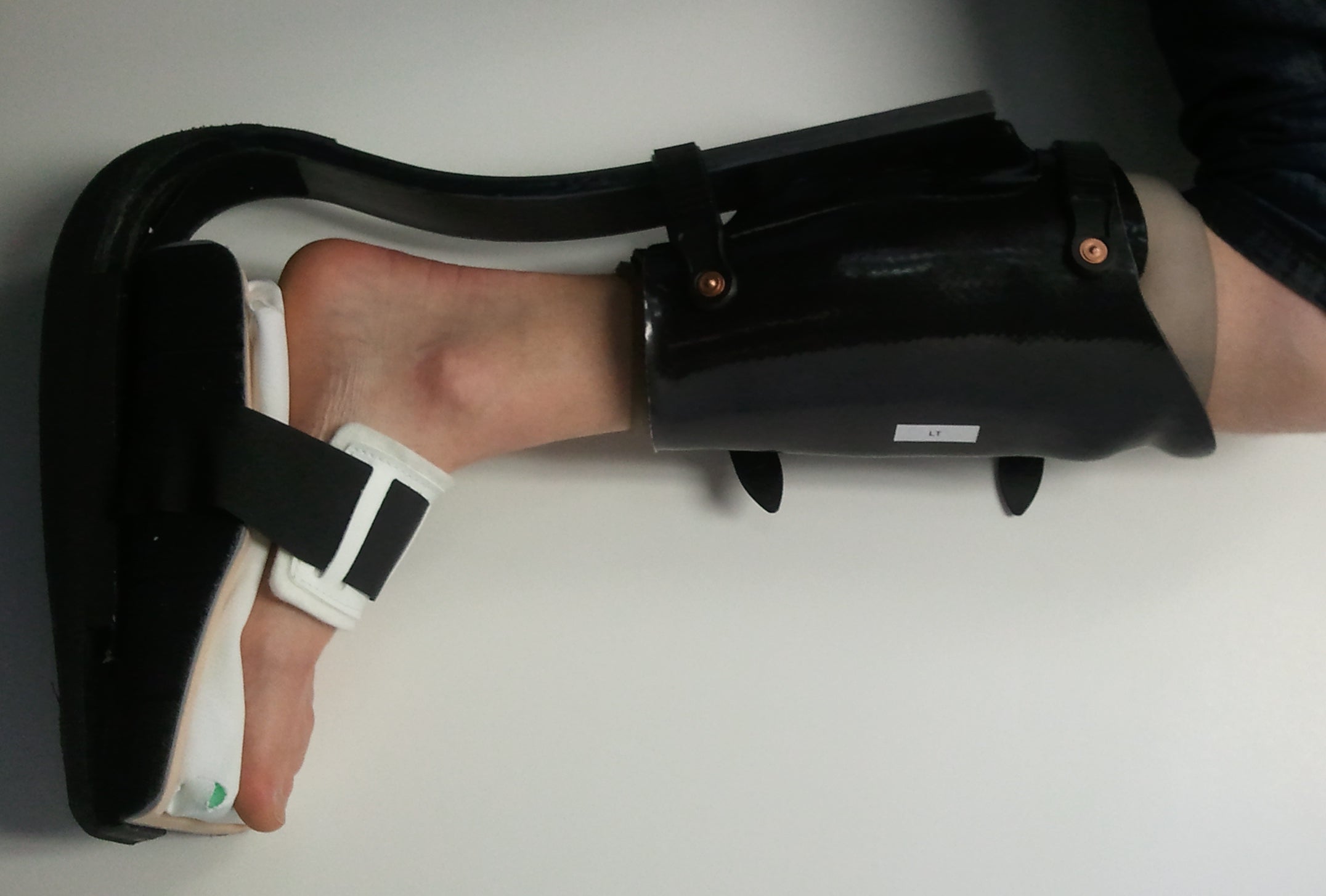 Improve the Toad Anti-Gravity Foot Brace ("TAG" Brace) : 6 Steps