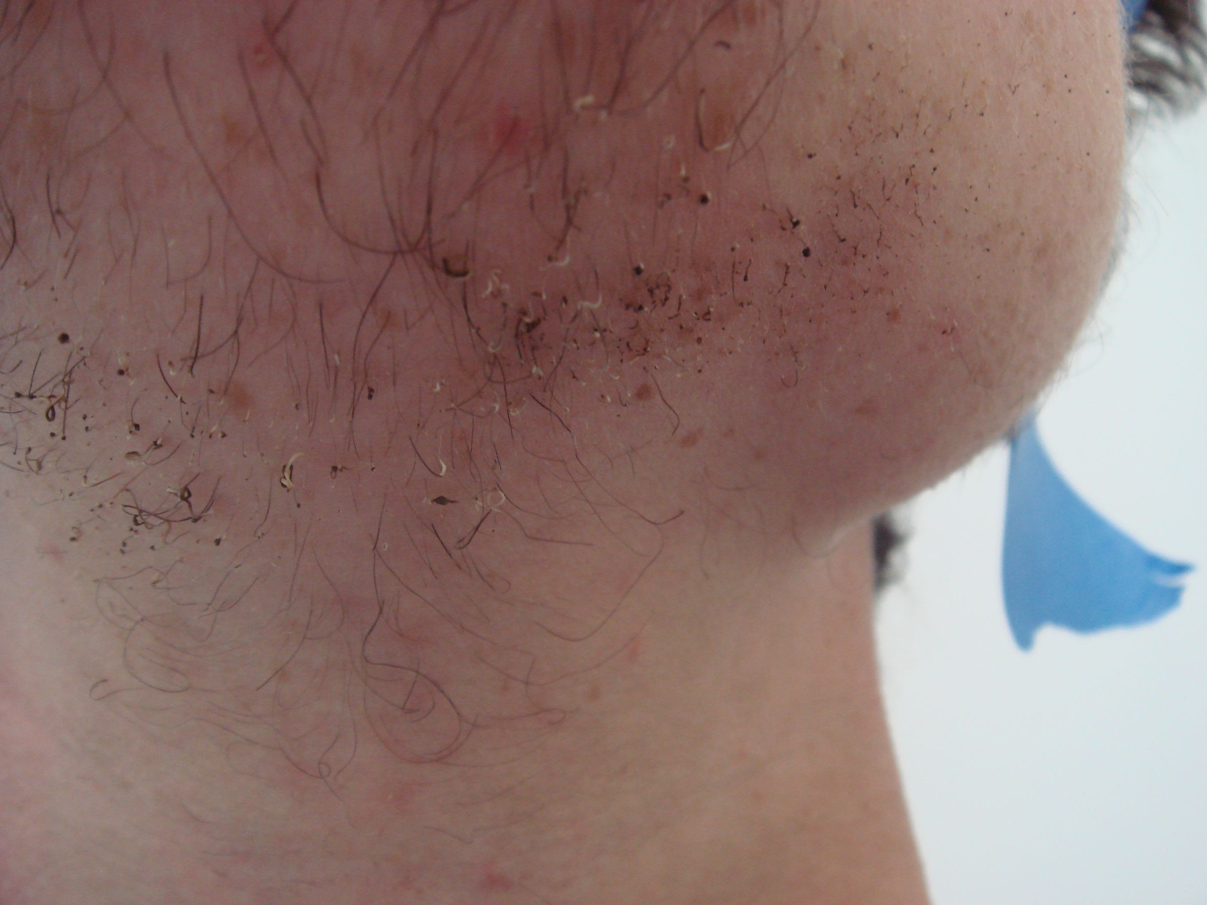 Fire Shaving 5 Steps (with Pictures) Instructables