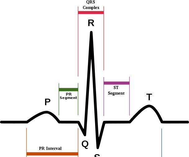 Arduino Portable EKG Monitor