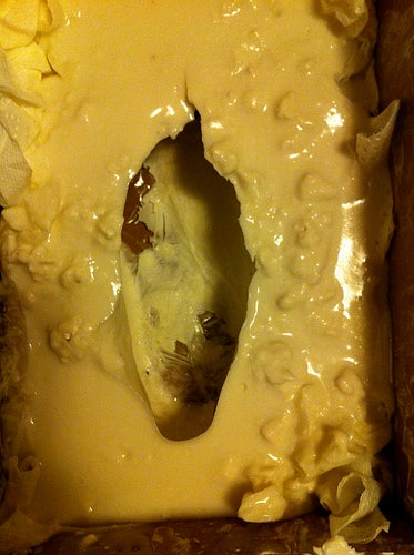 Casting Your Foot: Removing Your Foot