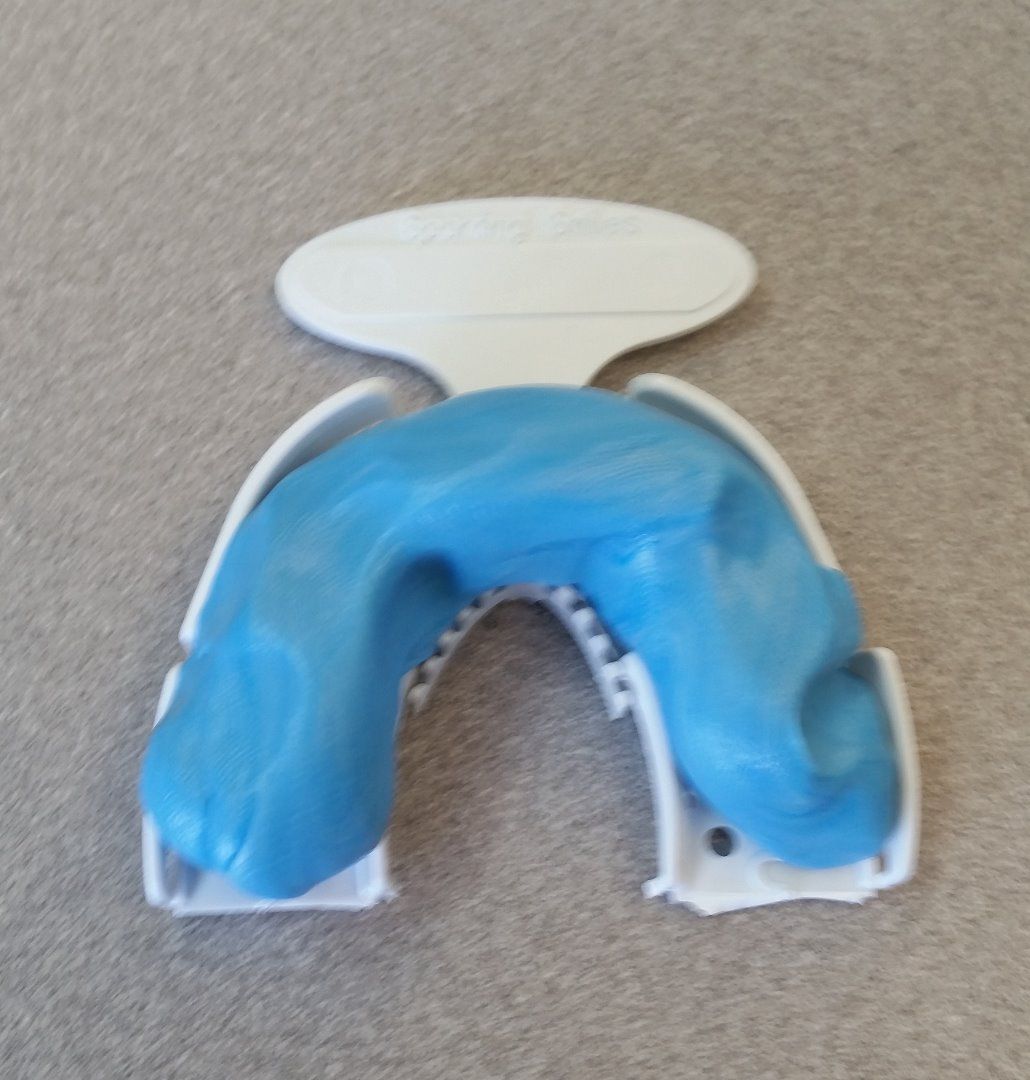 How to Take a Dental Impression. 4 Steps Instructables