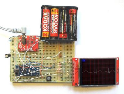 ECG Display With Arduino : 13 Steps (with Pictures) - Instructables