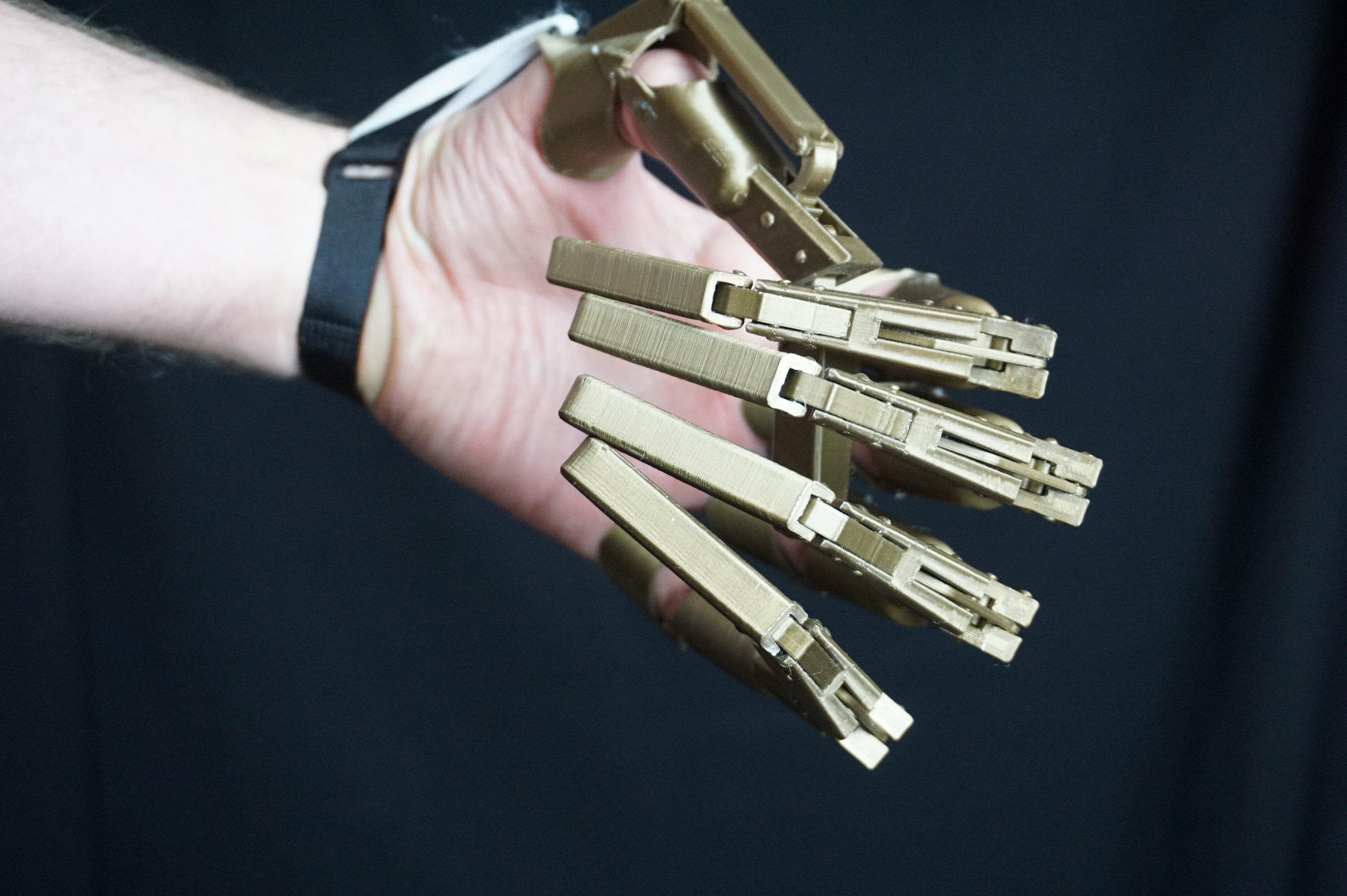 3D Printed Articulated Finger Extensions 14 Steps (with Pictures