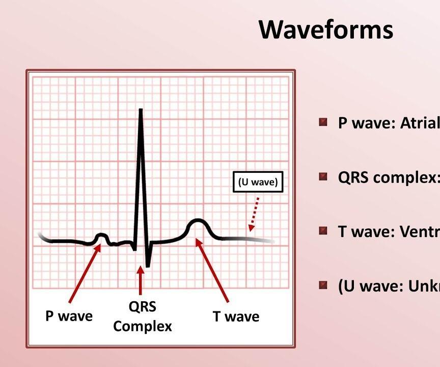 Simulated ECG Circuit 7 Steps Instructables