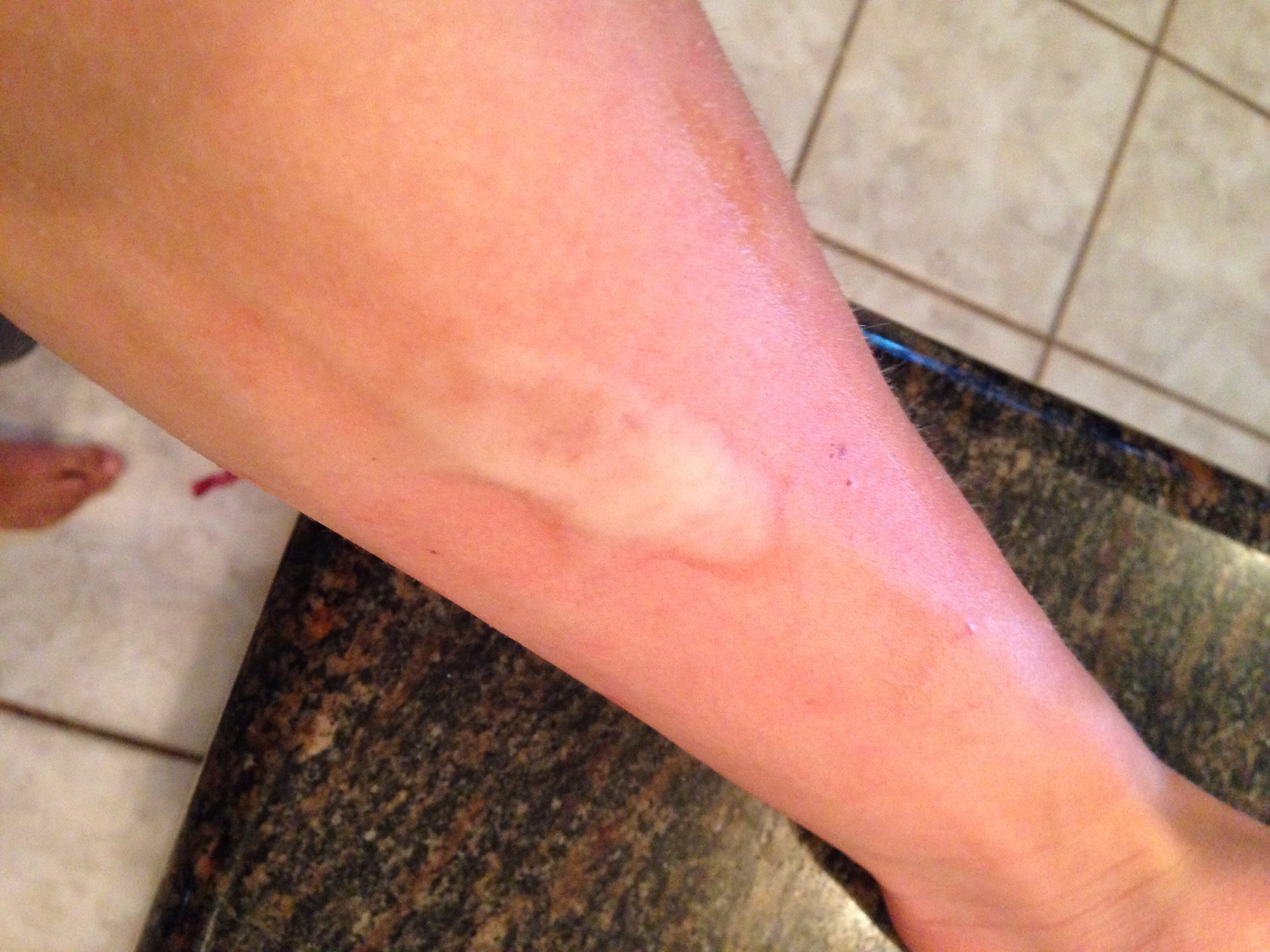 Fake Wounds From Vaseline 3 Steps Instructables