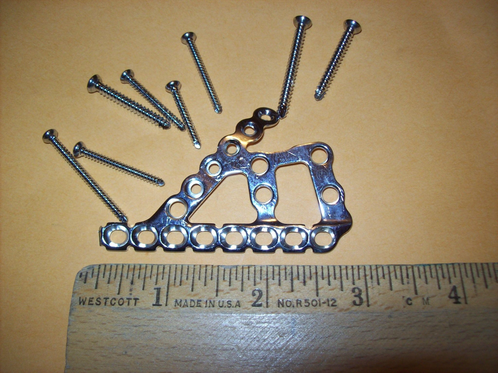 Orthopedic Hardware Instructables