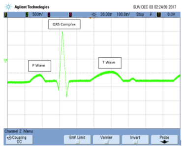 ECG and Heart Rate Virtual User Interface : 9 Steps - Instructables