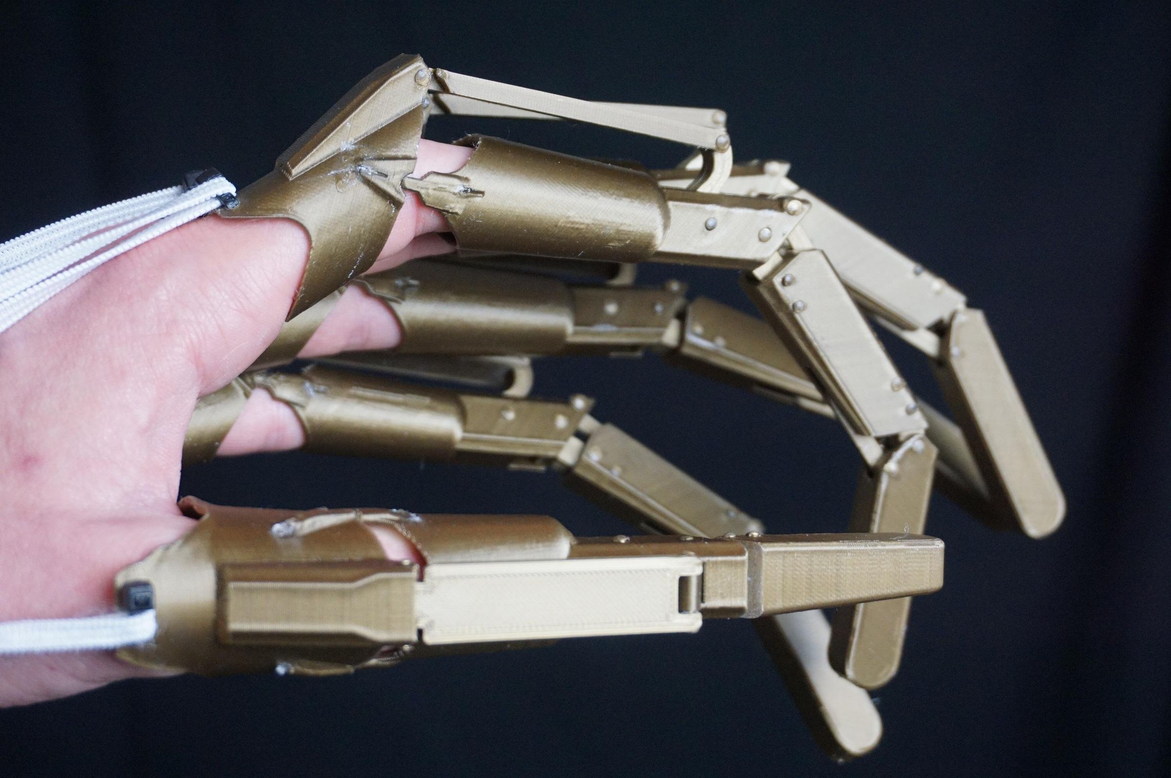 3D Printed Articulated Finger Extensions 14 Steps (with Pictures