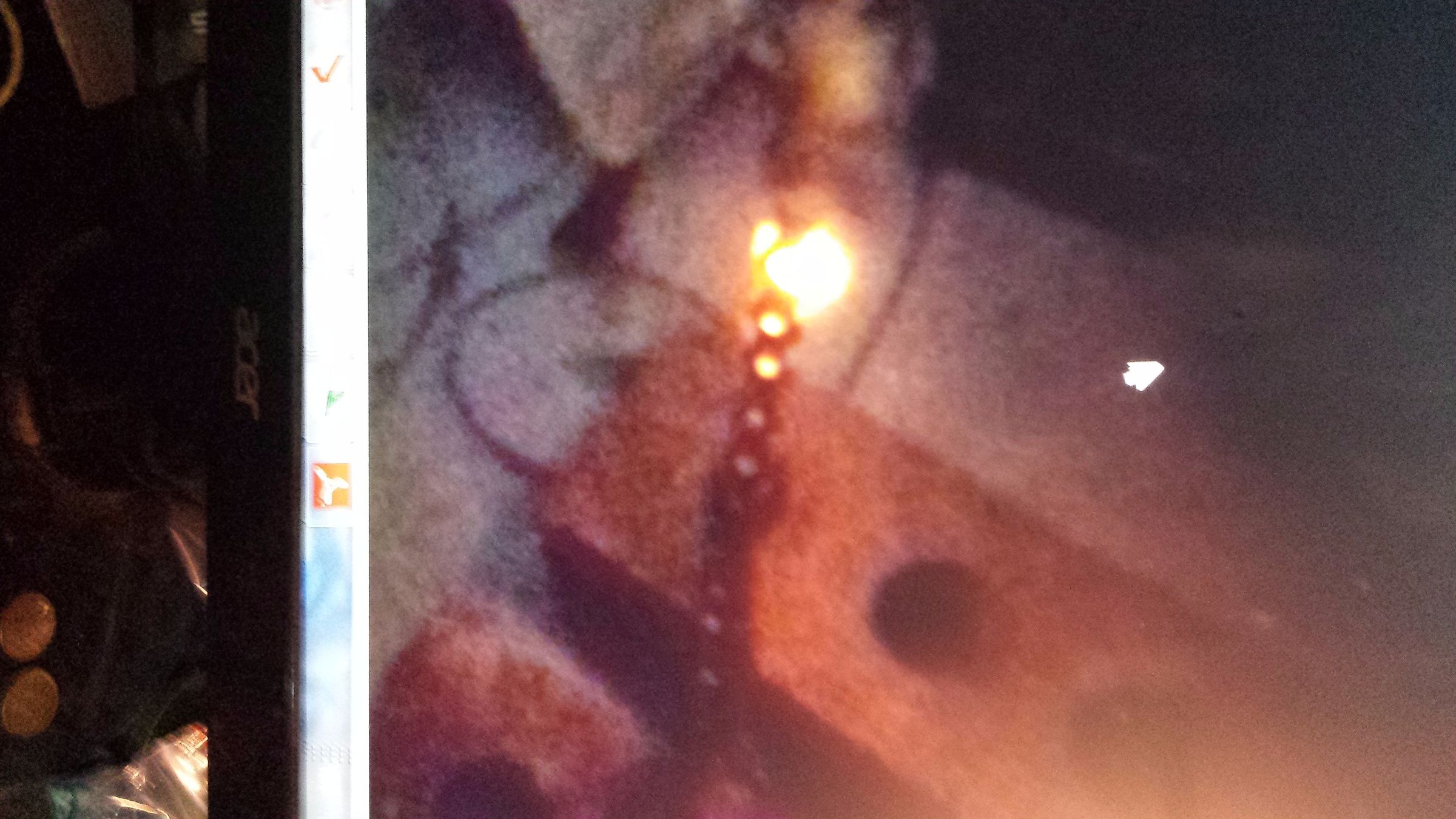 Jacob's Ladder 4 Steps (with Pictures) Instructables