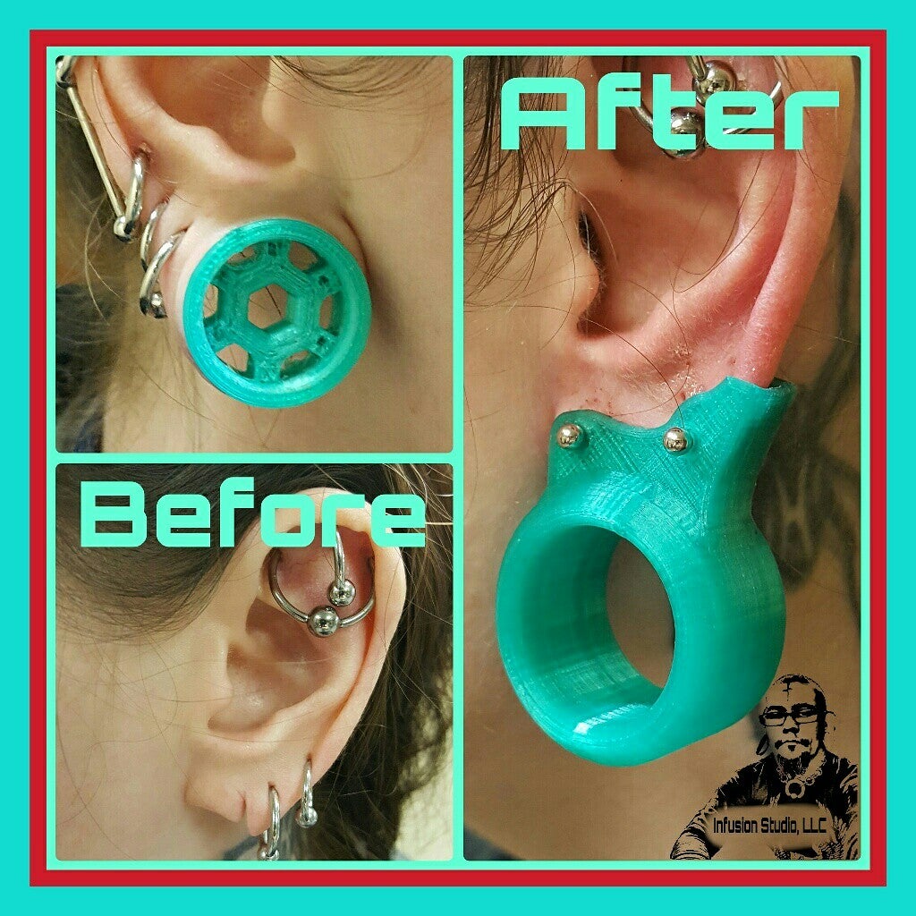 The First 3D Printed Prosthetic Stretched Lobe 6 Steps (with Pictures