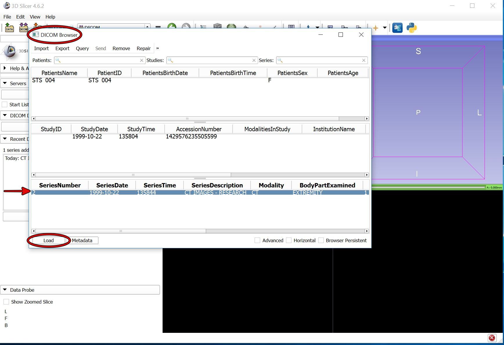 How to Easily and Automatically Convert a CT Scan Data) Into a