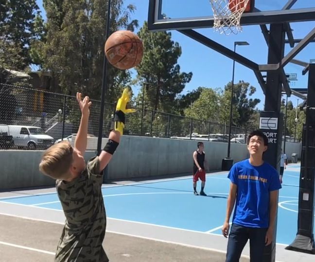 "spock" prosthetic basketball hand DIY Project DIY Project Image