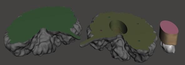 MRI to 3D Printable File (Artistic Approach) : 14 Steps (with Pictures ...