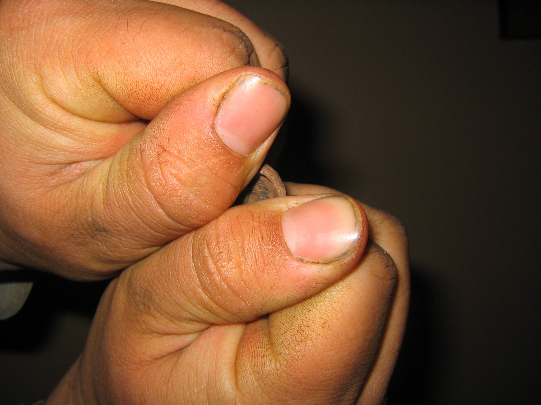Make a Super Loud Whistle With an Acorn or Other Pocketed Object 4