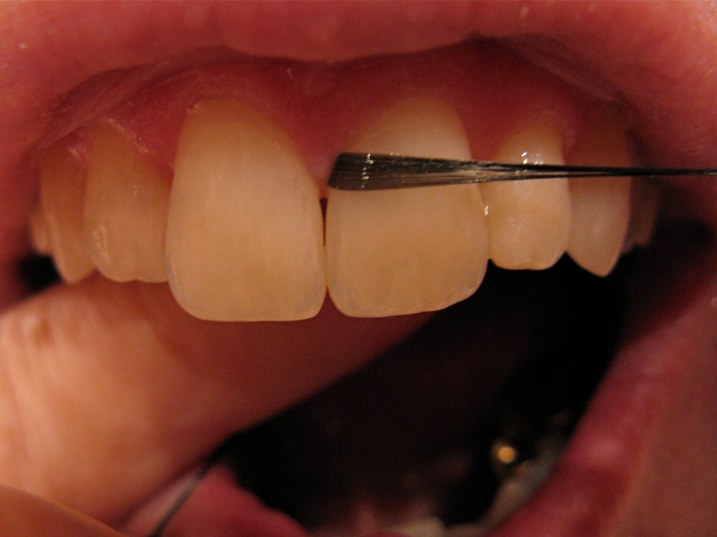 How To Floss Your Teeth 7 Steps With Pictures Instructables