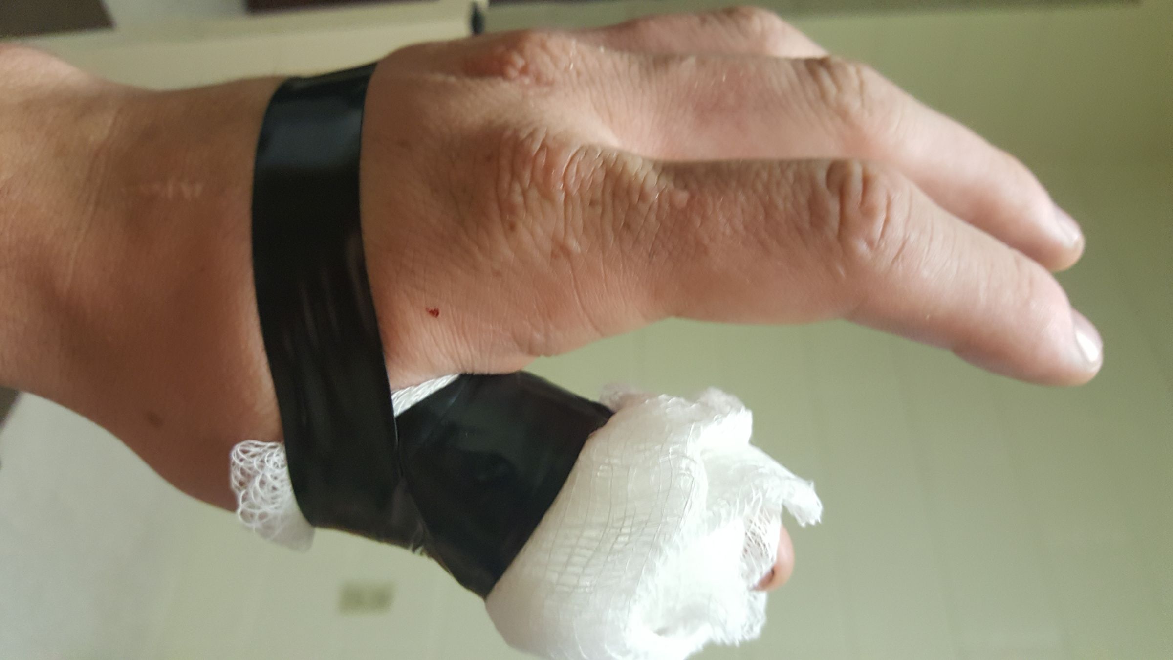 What to Do When You've Sliced Your Finger. 4 Steps Instructables