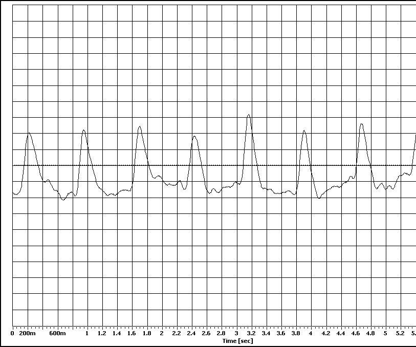 Another Heart Rate Monitor 3 Steps Instructables