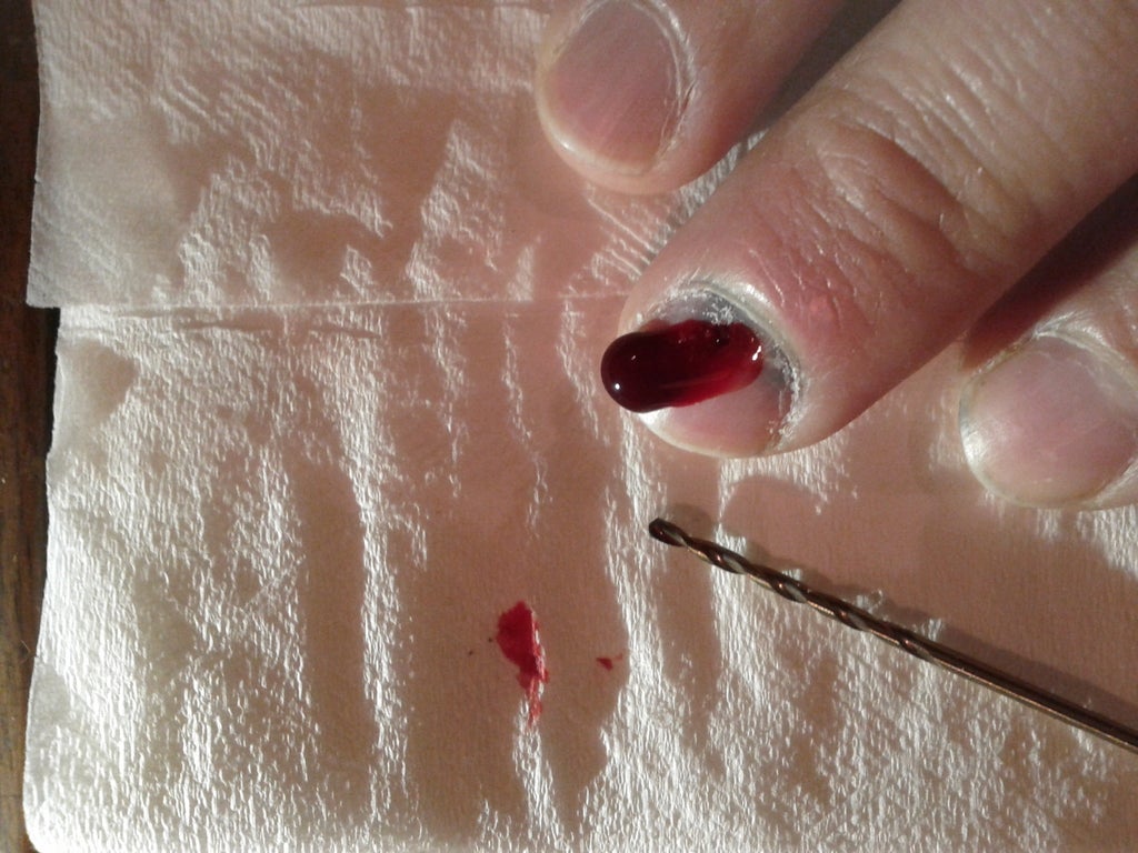 How To Drain Your Subungual Hematoma Blood Pocket Under Finger Nail With A Drill Bit 6 Steps With Pictures Instructables How To Drain Your Subungual Hematoma Blood Pocket Under Finger Nail With A Drill Bit 6 Steps With Pictures Instructables