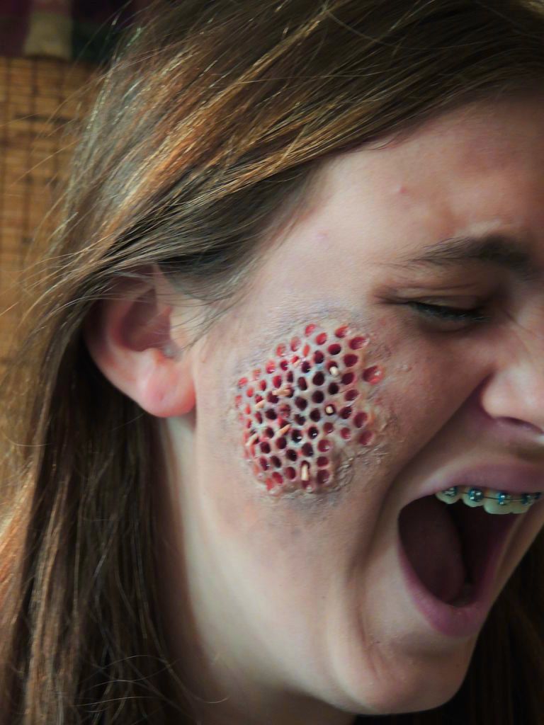 Maggot Infested Skin Trypophobia Doctor Costume 5 Steps With Pictures Instructables