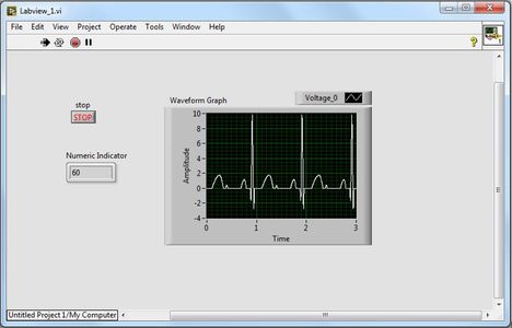 Labview Ecg Electrocardiogram (ECG) Circuit : 7 Steps - Instructables