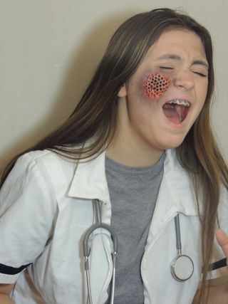 Maggot Infested Skin Trypophobia Doctor Costume 5 Steps With Pictures Instructables