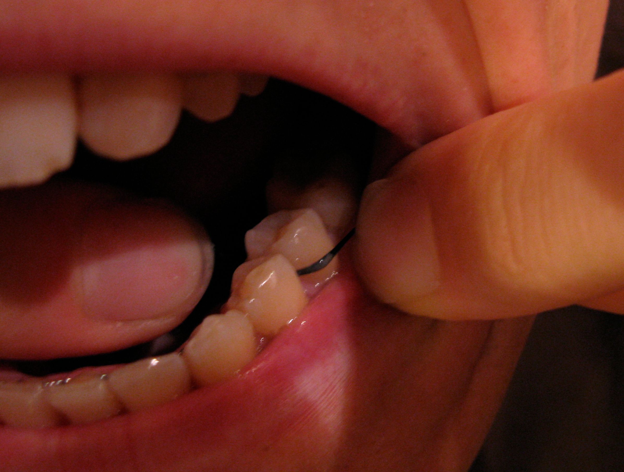 How to Floss Your Teeth 7 Steps (with Pictures) Instructables