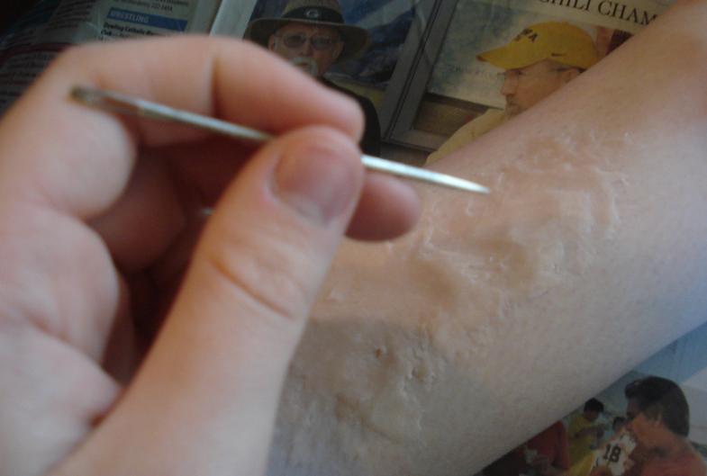 How To Create A Fake Wound : 5 Steps (With Pictures) - Instructables