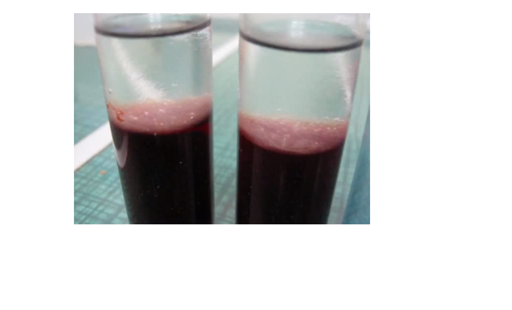 DIY guide for Extract your own dna from blood with step-by-step instructions