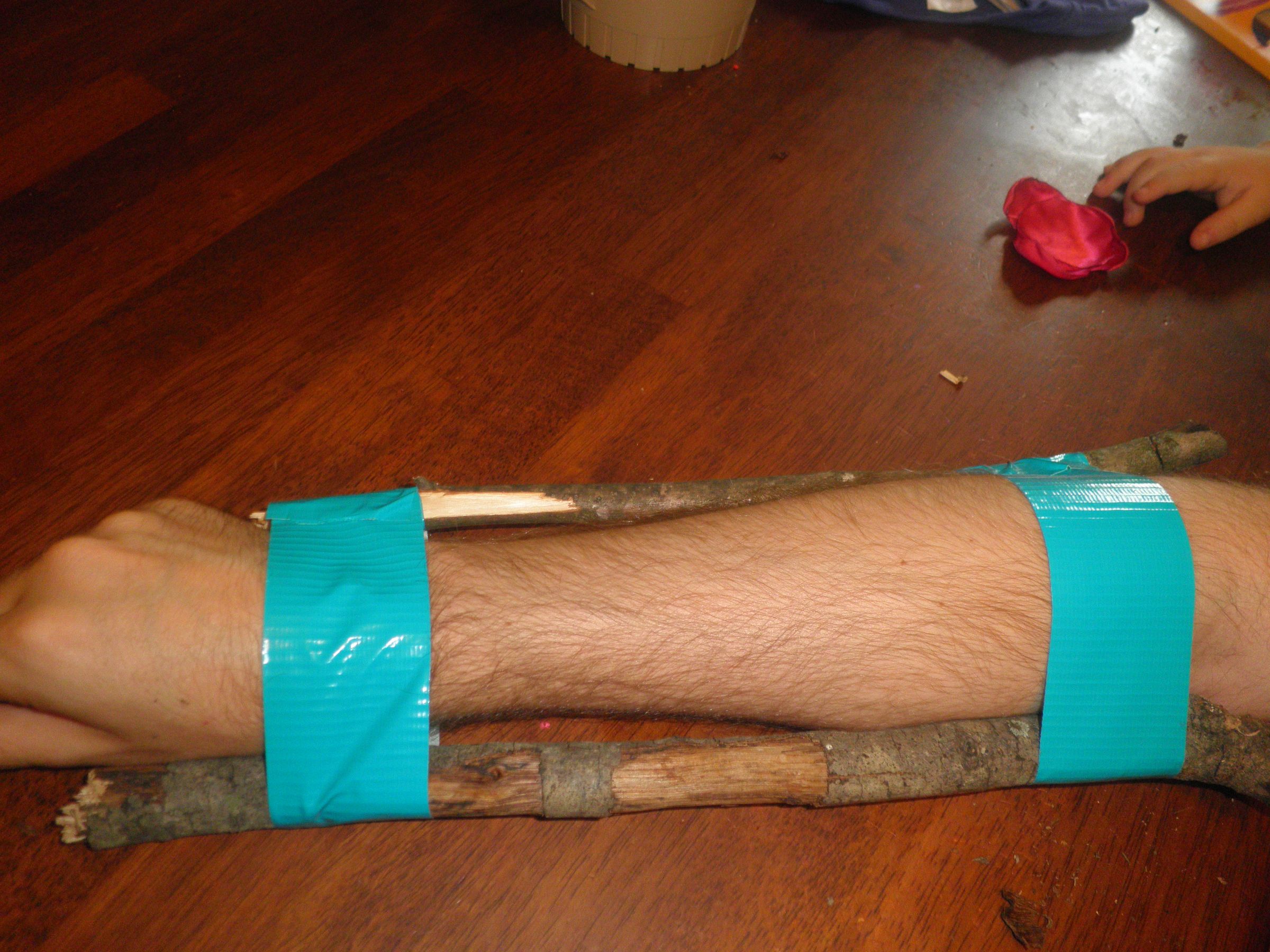 Duct Tape in Your First Aid Kit 8 Steps (with Pictures) Instructables