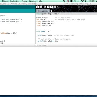 Arduino Based ECG & Heartbeat Monitoring Healthcare System : 8 Steps ...