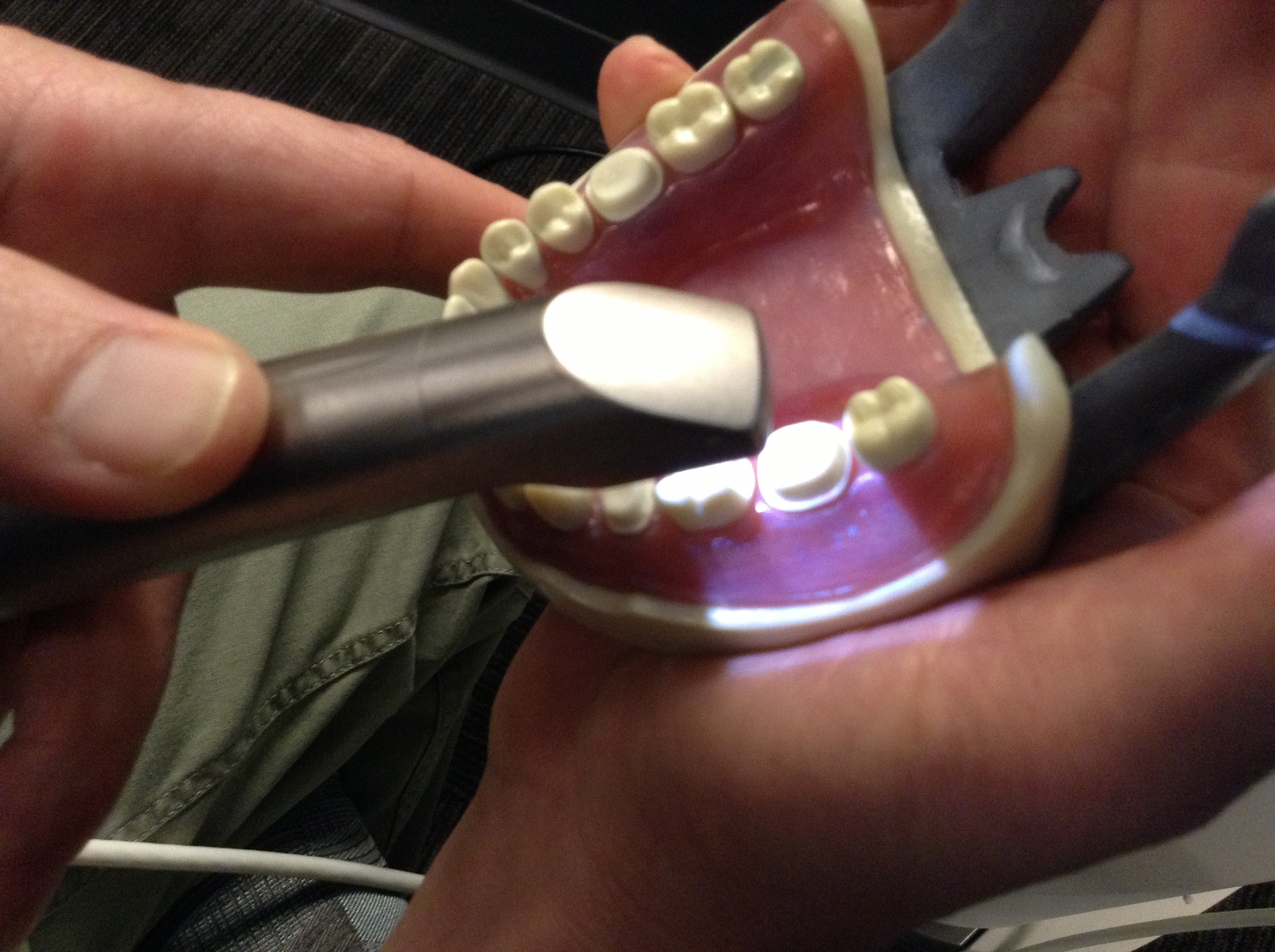 How to Fix a Tooth With CAD/CAM (CEREC) 9 Steps (with Pictures