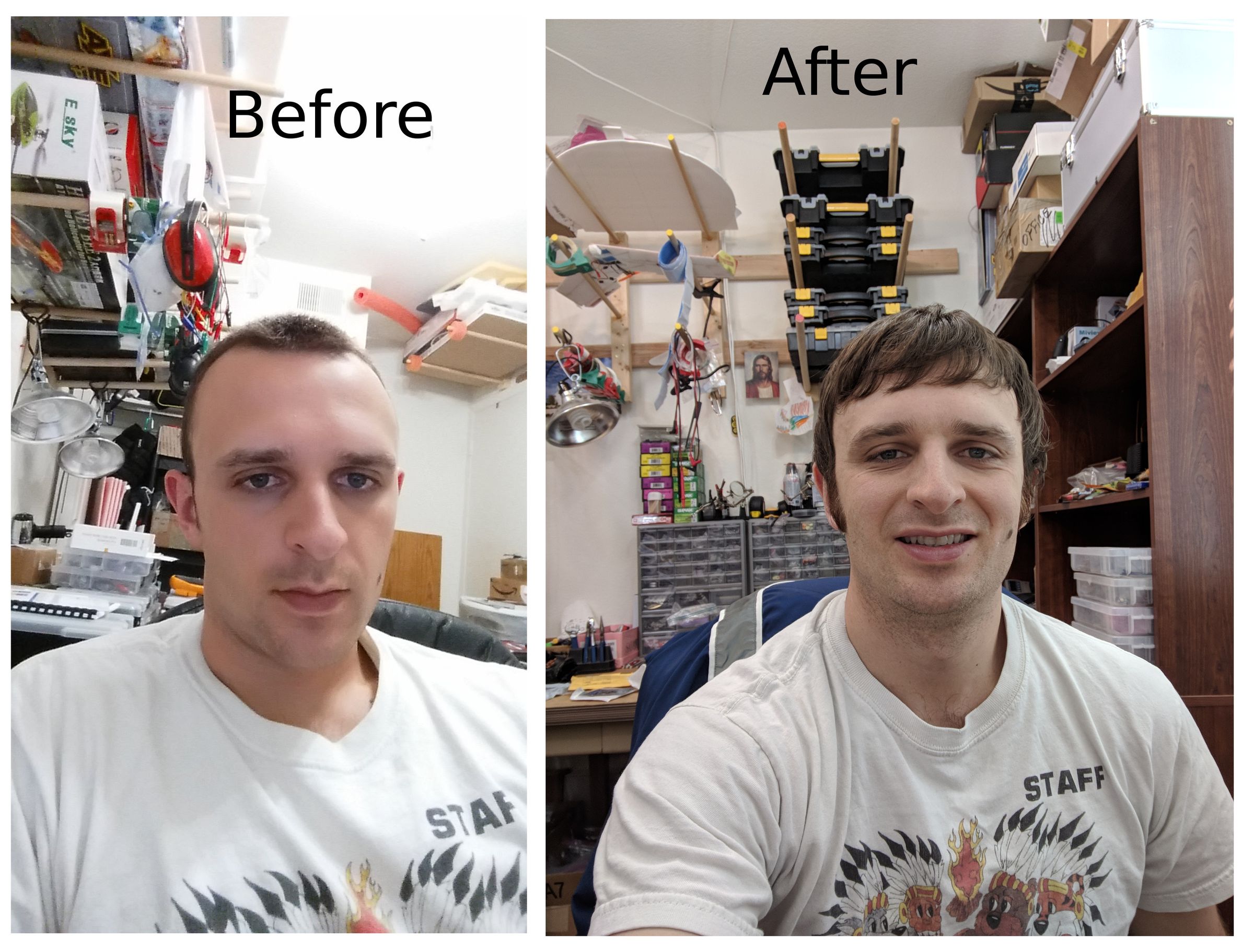 Separating instead of acquiring adsc image